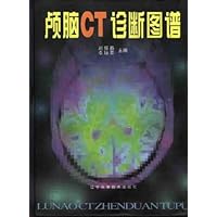 颅脑CT诊断图谱