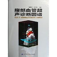 腹部血管超声诊断图谱
