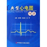 典型心电图图谱