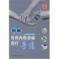 图解骨科内伤杂病治疗手法