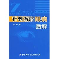 针刺治疗眼病图解
