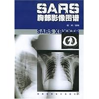 SARS胸部影像图谱