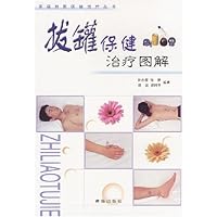 拔罐保健治疗图解