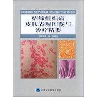 结缔组织病皮肤表现图鉴与诊疗精要
