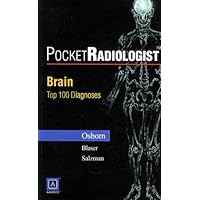 袖珍放射专家:脑部的100个主要诊断(英文版)
