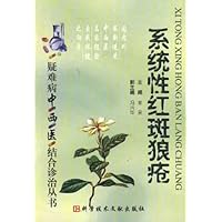 系统性红斑狼疮