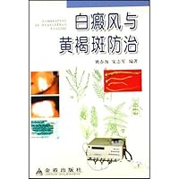 白癜风与黄褐斑防治