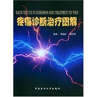 疼痛诊断治疗图解
