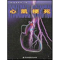 心肌梗死